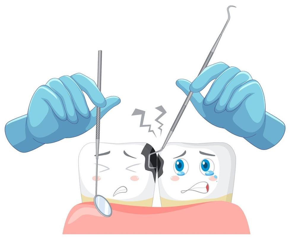 Cartoon tooth with gloves holding scissors, symbolizing dental care and composite bonding procedures.