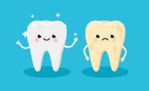 Two cartoon tooth characters with different expressions, promoting Composite Bonding by Pinner Green Dental.