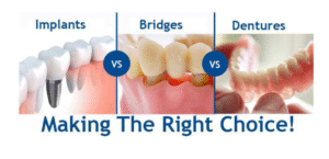Missing Tooth is Quietly Causing Chaos in Your Mouth 