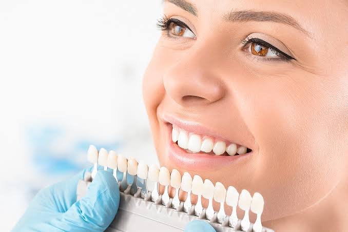 Teeth Whitening at the Dentist: A Complete Guide to What Actually Works